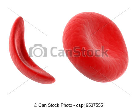 Of Sickle Cell Blood Cell   Scientific Illustration   Sickle