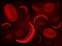 Sickle Cell And Normal Red Blood Cells Stock Image