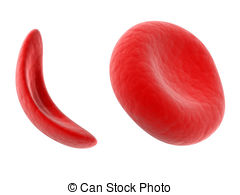 Sickle Cell Blood Cell   Scientific Illustration   Sickle