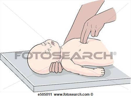 Clipart Of Chest Compressions For An Infant  One Or Two Fingers Only    