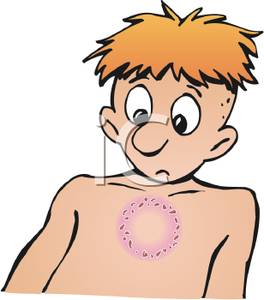 Little Boy With A Rash On His Chest   Royalty Free Clipart Picture