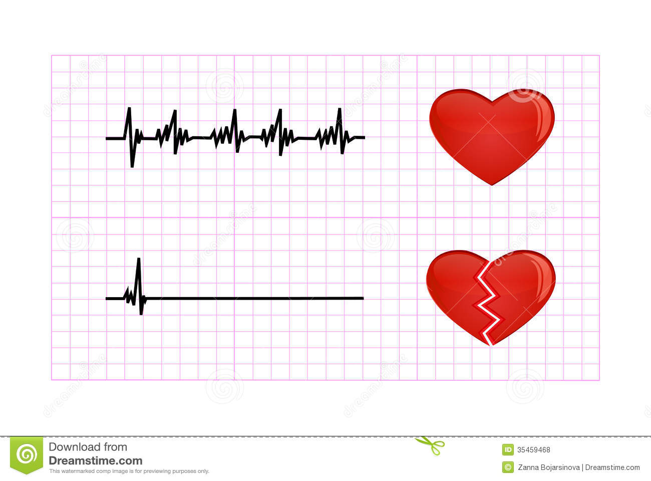 Heartbeat Monitor Clipart Heartbeat Diagram Illustration