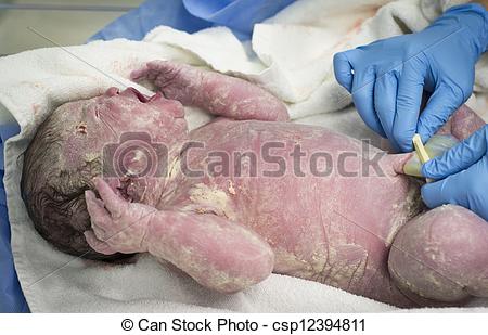 Stock Photo   New Born Baby Girl With Clamped Umbilical Cord   Stock    