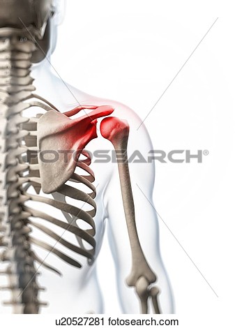 Clipart   Human Shoulder Pain Artwork  Fotosearch   Search Clip Art