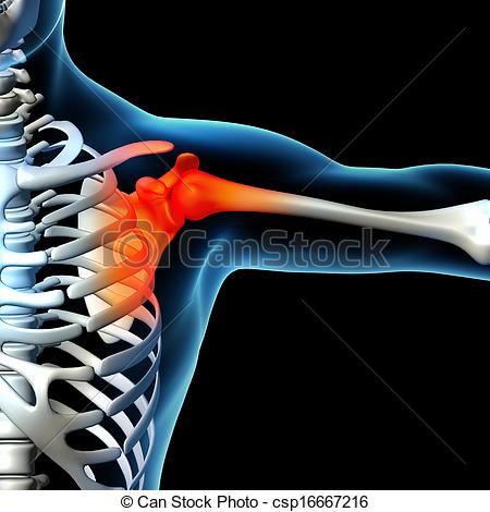 Human Shoulder Clipart Human Shoulder Pain With The
