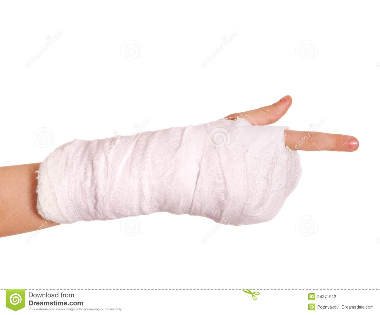 Arm Cast Clipart Broken Arm In A Cast 