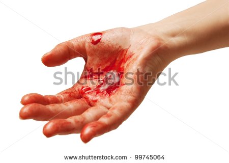 Hand Injury Clipart Bloody Hand Symbolizing Injury