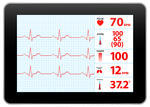 Beatbloodcardiogramcaredisplayecgecg Monitorekgekg Machine    