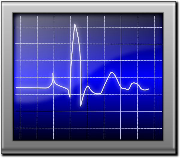 Heart Monitor Clipart Green Heart Rate Monitor