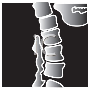 Cartoon X Ray Of A Spine