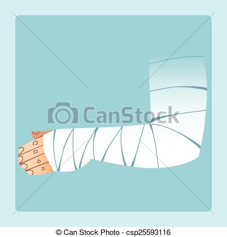 Vector Clip Art Of Bandaged Hand After Fracture Or Injury Medicine And