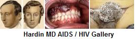 Hardin Md   Aids Pictures   Hiv Pictures