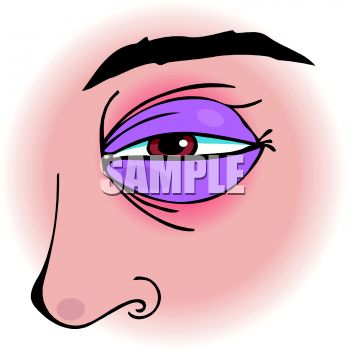 Clipart Free  A Black Eyequot  Clipart Image A Black Eyequot  Clipart