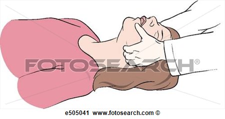 Clipart Of Three Step Procedure For Applying A Pocket Mask To A Victim