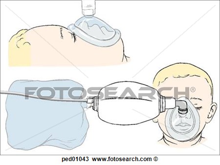 Typical Self Inflating Bag Valve Mask Circuit  View Large Illustration