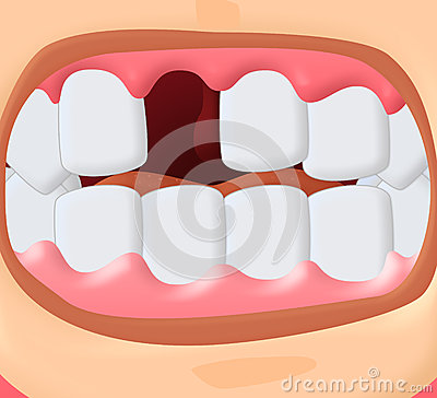 Toothless Smile Clipart Toothless 27859328 Jpg