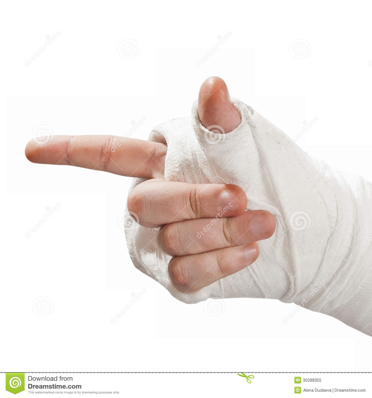 Broken Arm In A Cast  Finger Pointing Aside Royalty Free Stock Photo    
