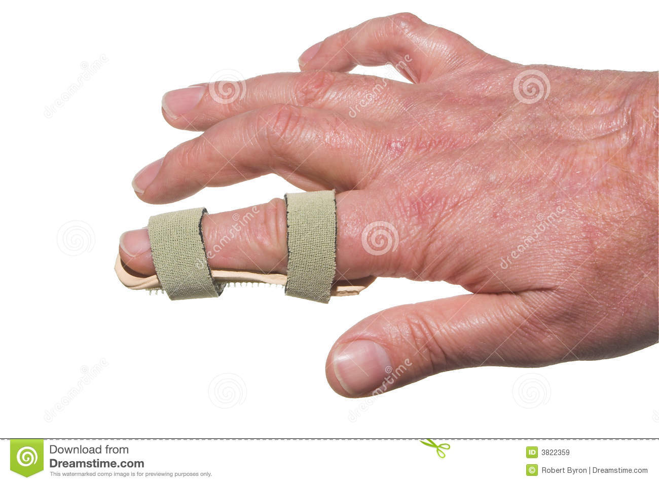 Broken Finger Royalty Free Stock Images   Image  3822359