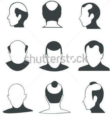Download Source File Browse   Healthcare   Medical   Silhouette Bald