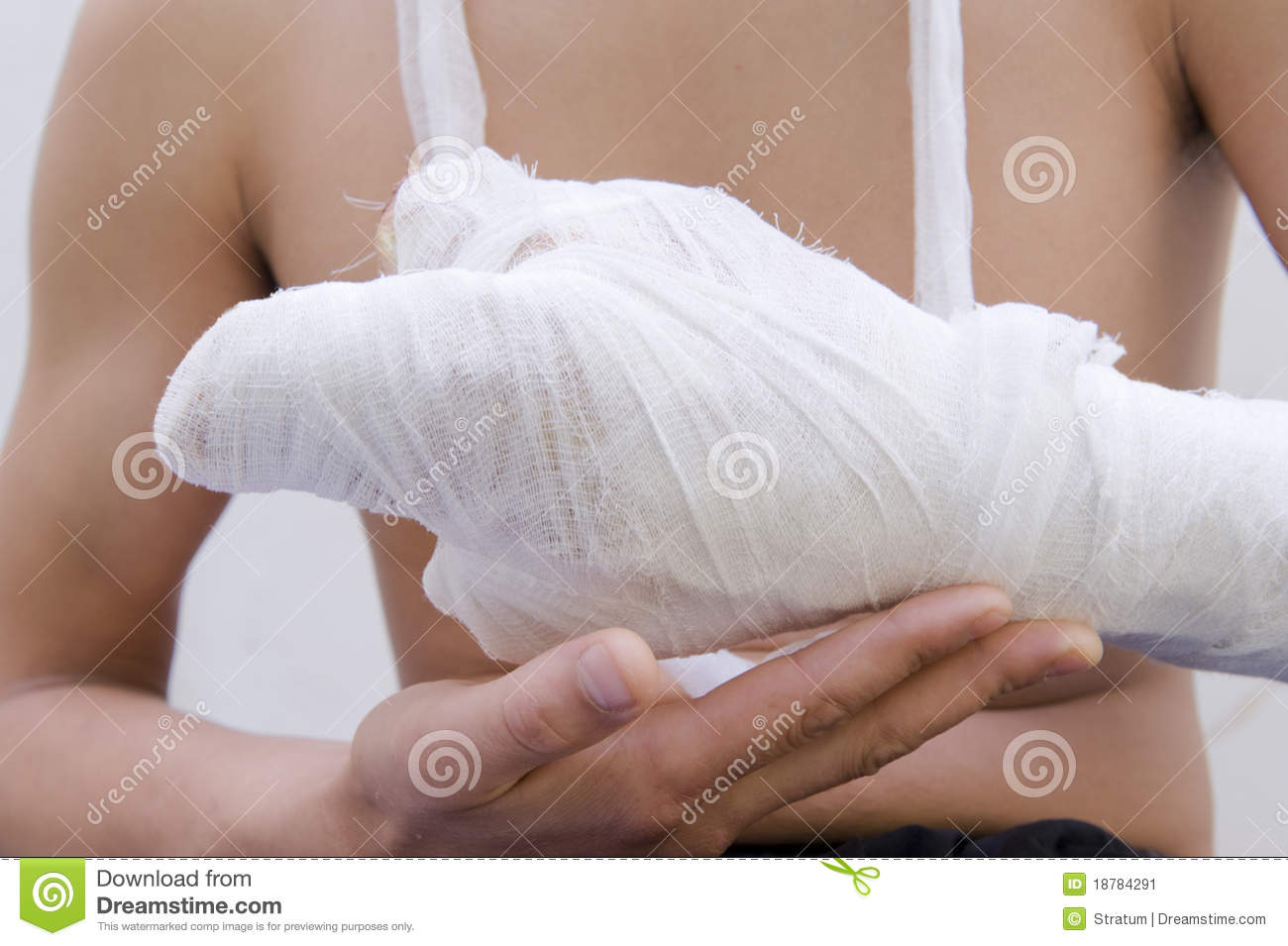Injured Hand Stock Image   Image  18784291