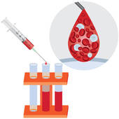 Blood Test    Clipart Graphic