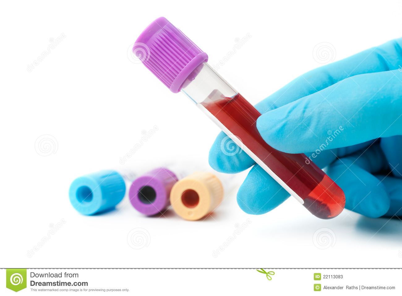 Hand Holding Test Tube With Blood Plasma Ready For Testing