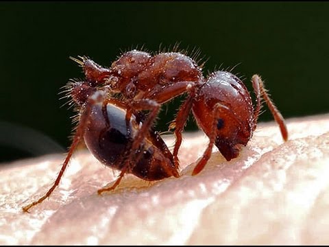 Diy Fire Ant Bite   Sting Home Remedy Treatment   Youtube