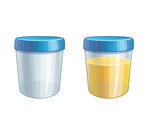 Vector Illustration Of Urine Sample Full And Empty Container Empty