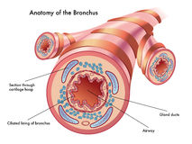 Structure Of Damaged Bronchial Mucosa With Sputum Vector Illustration