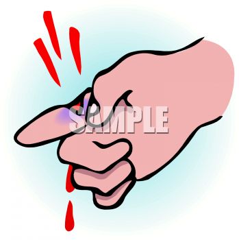 Royalty Free Clipart Image  Deep Cut On A Finger