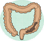 Bowel In Large Intestine Royalty Free Stock Photography