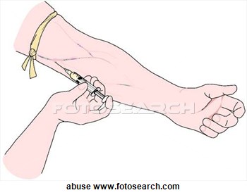 Clipart Of Drug Abuse Injection Abuse   Search Clip Art Illustration