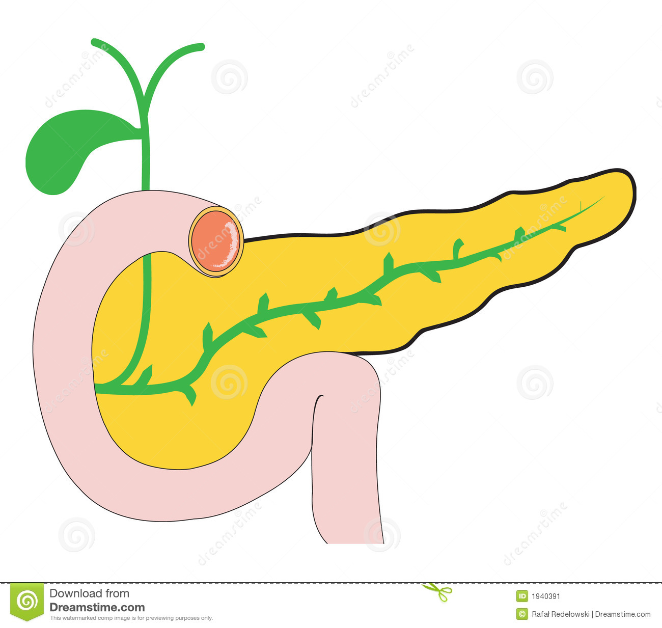 Yellow Pancreas With Part Of Small Intenstine And Gallbladder