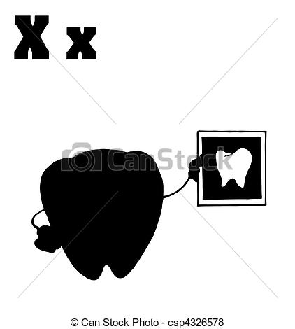 Xray   Silhouetted Tooth Holding An Xray    Csp4326578   Search Clip    