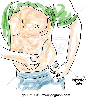 Stock Illustration   An Image Of A Diabetes Insulin Injection Site