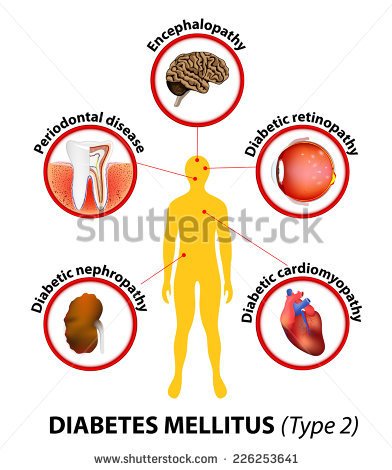 Untreated Diabetes Can Cause Many Complications  Heart Disease