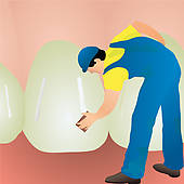 Teeth Cleaning Stock Illustrations   Gograph