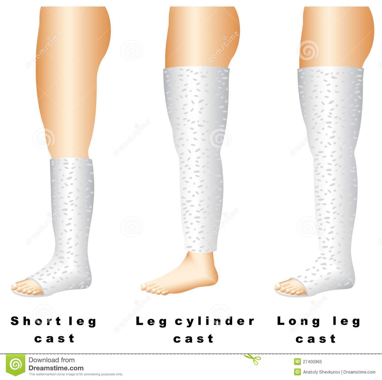 Clip Art Leg Cast Clip Art Broken Arm Clip Art Broken Leg Clip Art