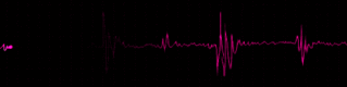 Hot Pink Heartbeat Black Background Gif By Allliihavexll3