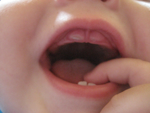 Baby Has Several Teeth Healthy Baby Teeth Is Crucial Although Teeth
