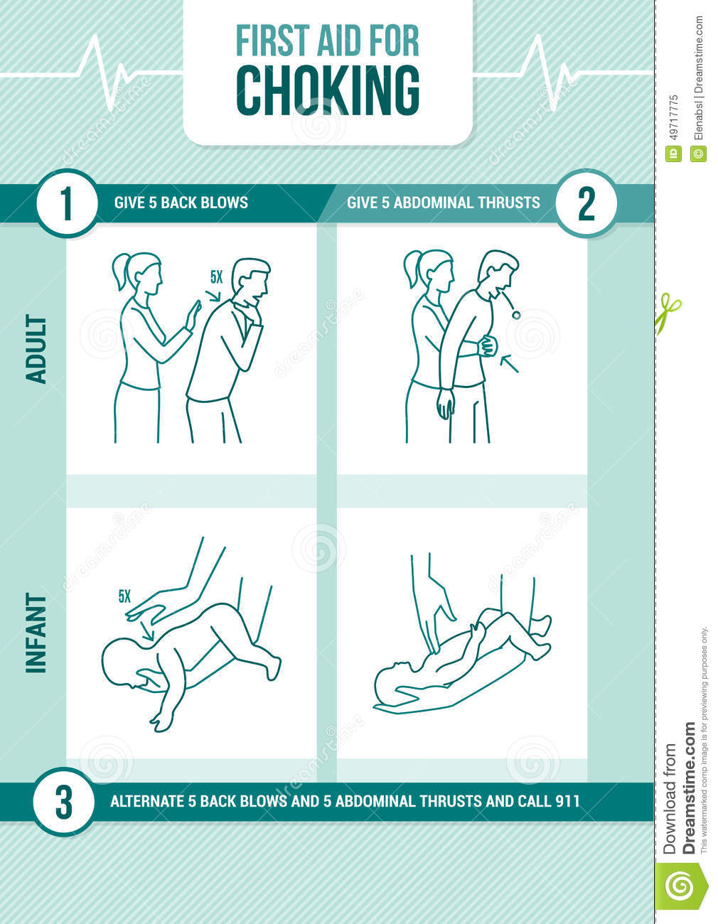 First Aid Procedure For Choking And Heimlich Maneuver For Adults And    