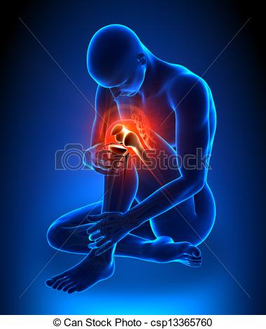 Stock Illustration Of Knee Pain Csp13365760   Search Clip Art