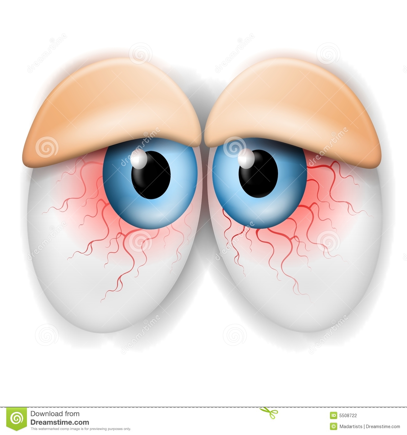 An Illustration Featuring A Pair Of Cartoonish Tired Droopy Bloodshot