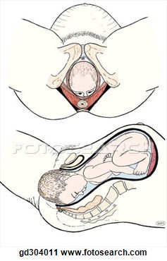 Pelvic Floor During Childbirth   Fotosearch   Search Clip Art