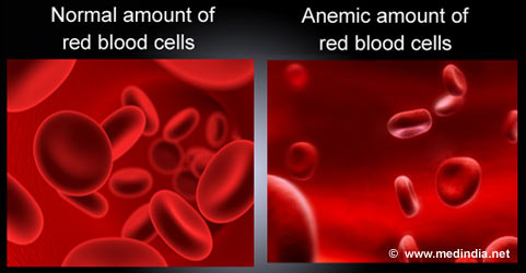 Anemia   Low Hemoglobin  Haemoglobin  Causes Symptoms Diagnosis