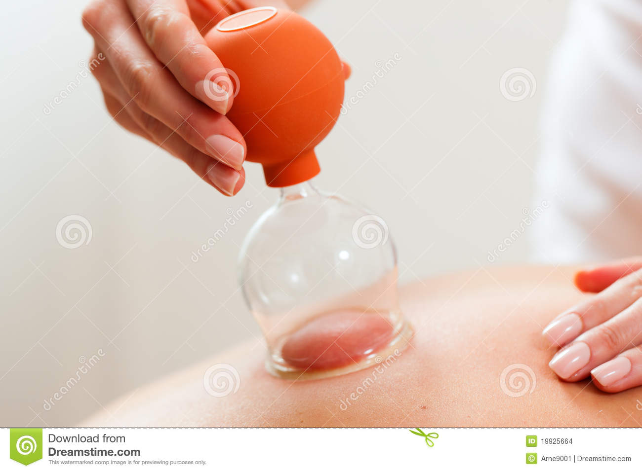 Patient At The Physiotherapy   Cupping Stock Images   Image  19925664