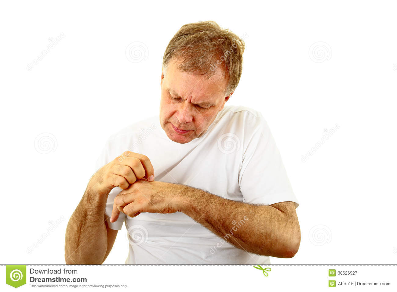 Itching Portrait Adult Man Scratch His Itchy Hand 30626927 Jpg