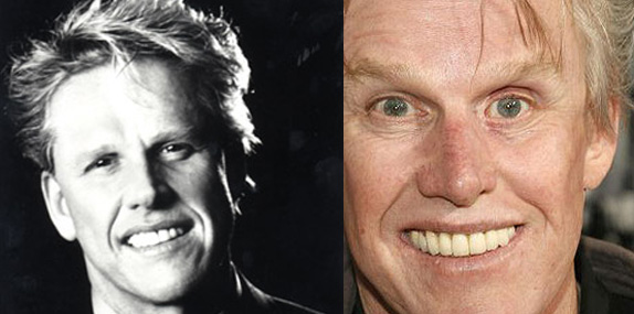 Gary Busey Before And After Gary Busey Before And After