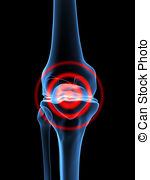 Pain In Knee   3d Rendered X Ray Illustration Of A Skeletal
