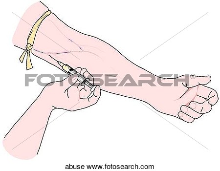 Clipart Of Drug Abuse Injection Abuse   Search Clip Art Illustration